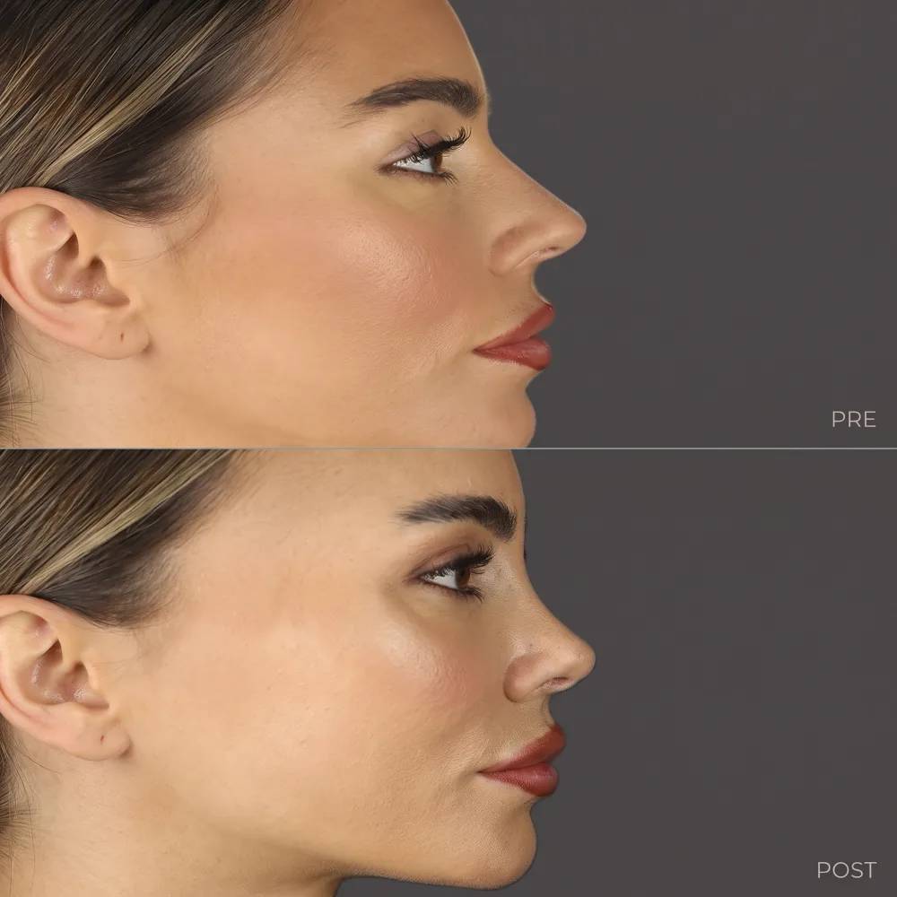 Facial Aesthetics